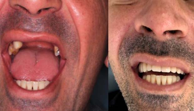 Antes-e-Depois-04b-Daniel-Mathias.jpg